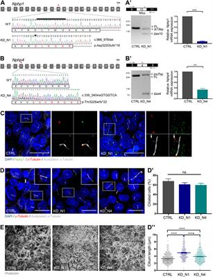 Fluid shear stress triggers cholesterol biosynthesis and uptake in inner medullary collecting duct cells, independently of nephrocystin-1 and nephrocystin-4